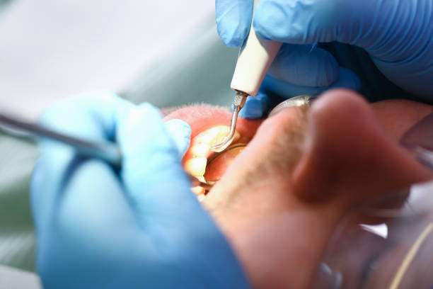 Best Emergency Denture Repair in Salem, AR